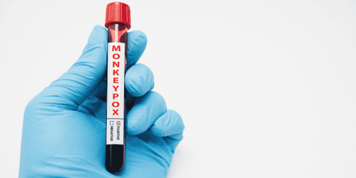 Hand wearing a blue glove holding a test tube labeled "Monkeypox" against a plain background.